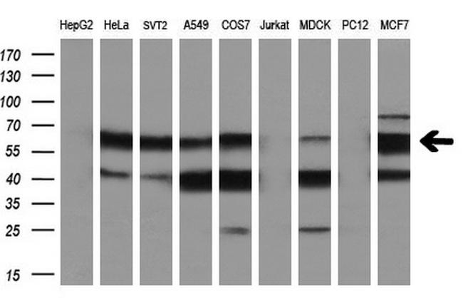 ESR1 Antibody in Western Blot (WB)