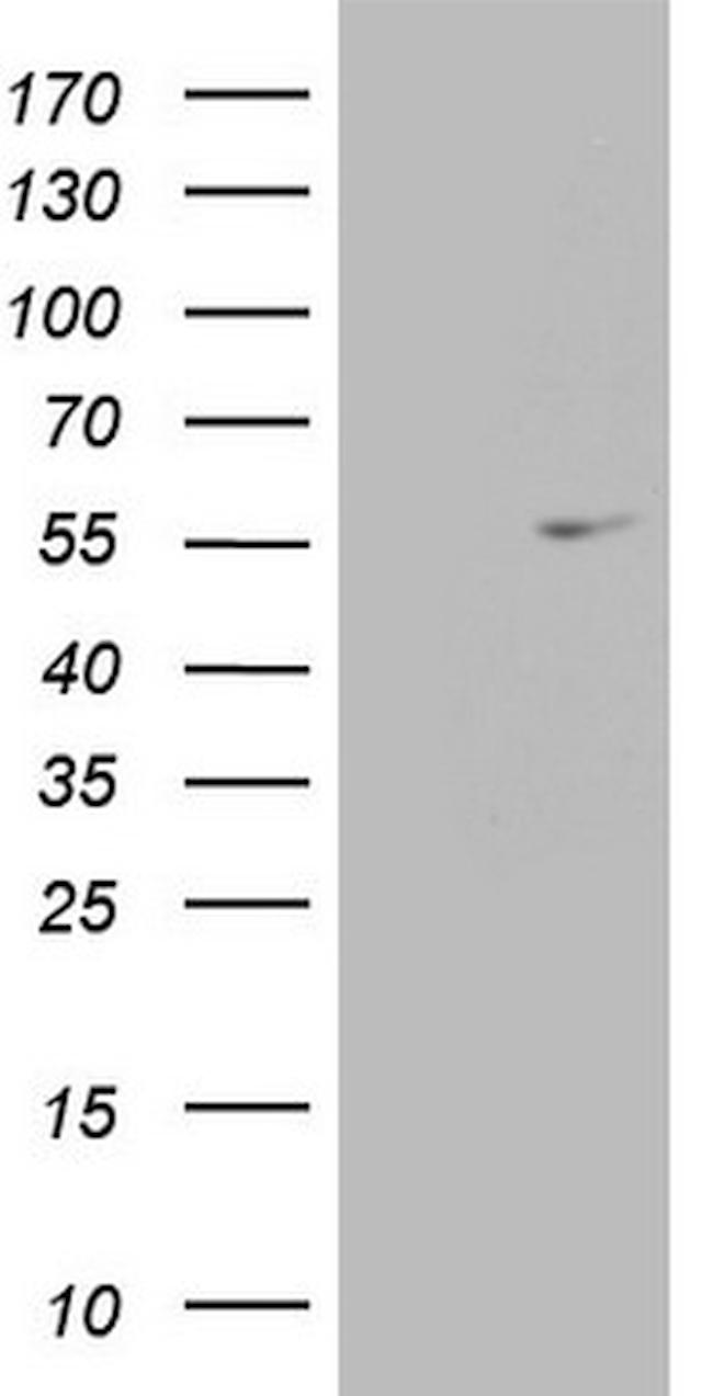 ESRRA Antibody in Western Blot (WB)