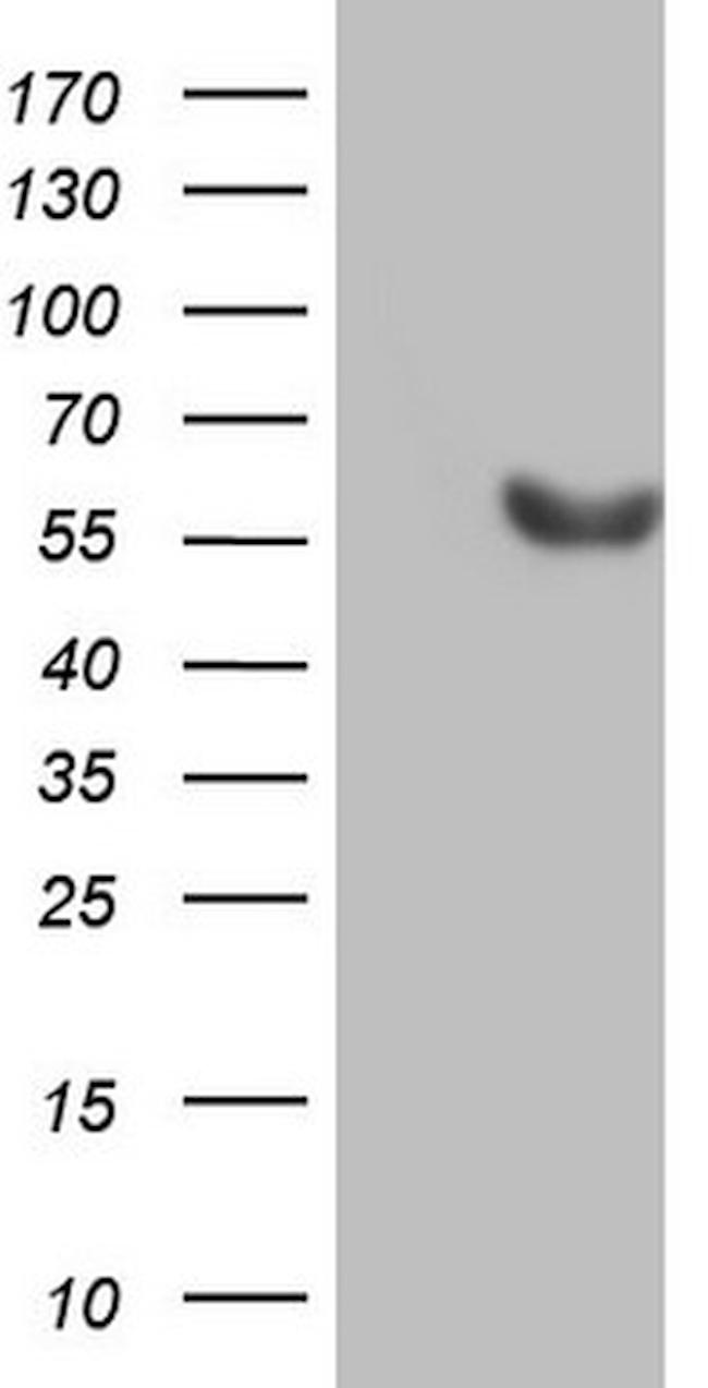 ESRRB Antibody in Western Blot (WB)