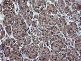 ESRRG Antibody in Immunohistochemistry (Paraffin) (IHC (P))