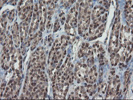 ESRRG Antibody in Immunohistochemistry (Paraffin) (IHC (P))