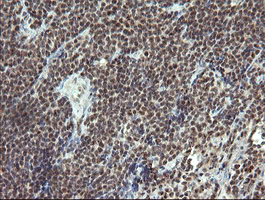 ESRRG Antibody in Immunohistochemistry (Paraffin) (IHC (P))