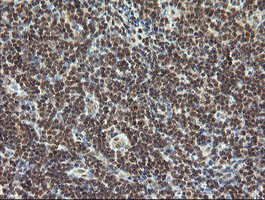 ESRRG Antibody in Immunohistochemistry (Paraffin) (IHC (P))