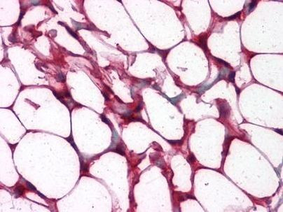 ETS1 Antibody in Immunohistochemistry (Paraffin) (IHC (P))