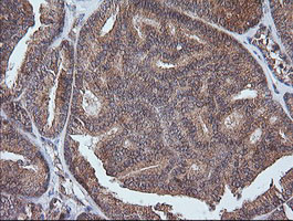 ETS2 Antibody in Immunohistochemistry (Paraffin) (IHC (P))