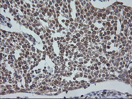 ETS2 Antibody in Immunohistochemistry (Paraffin) (IHC (P))