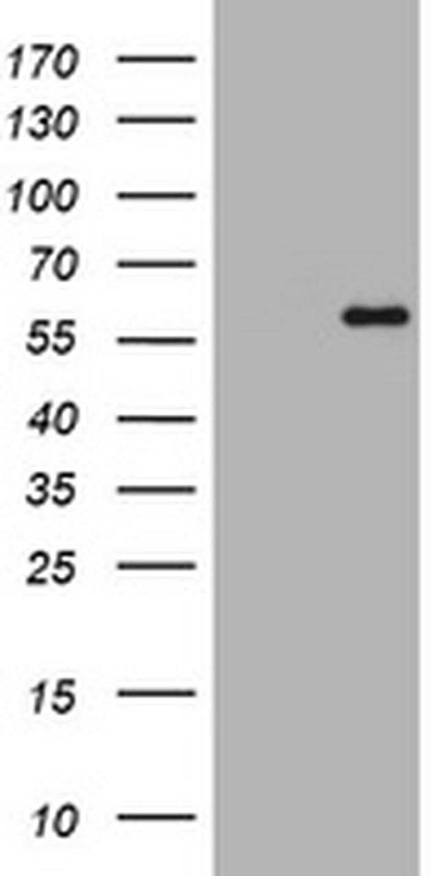 ETS2 Antibody in Western Blot (WB)