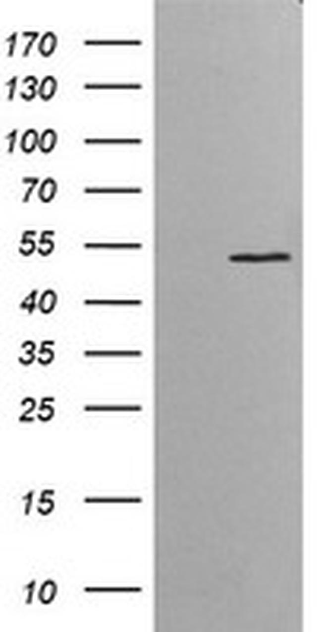 ETS2 Antibody in Western Blot (WB)