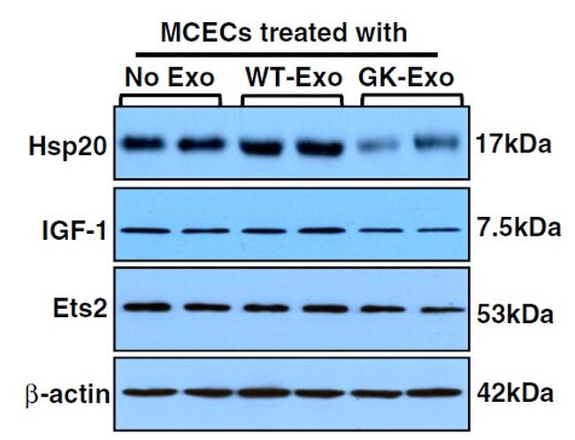 ETS2 Antibody in Western Blot (WB)