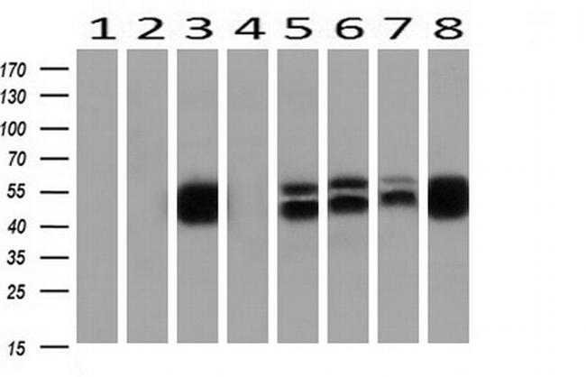 ETS2 Antibody in Western Blot (WB)