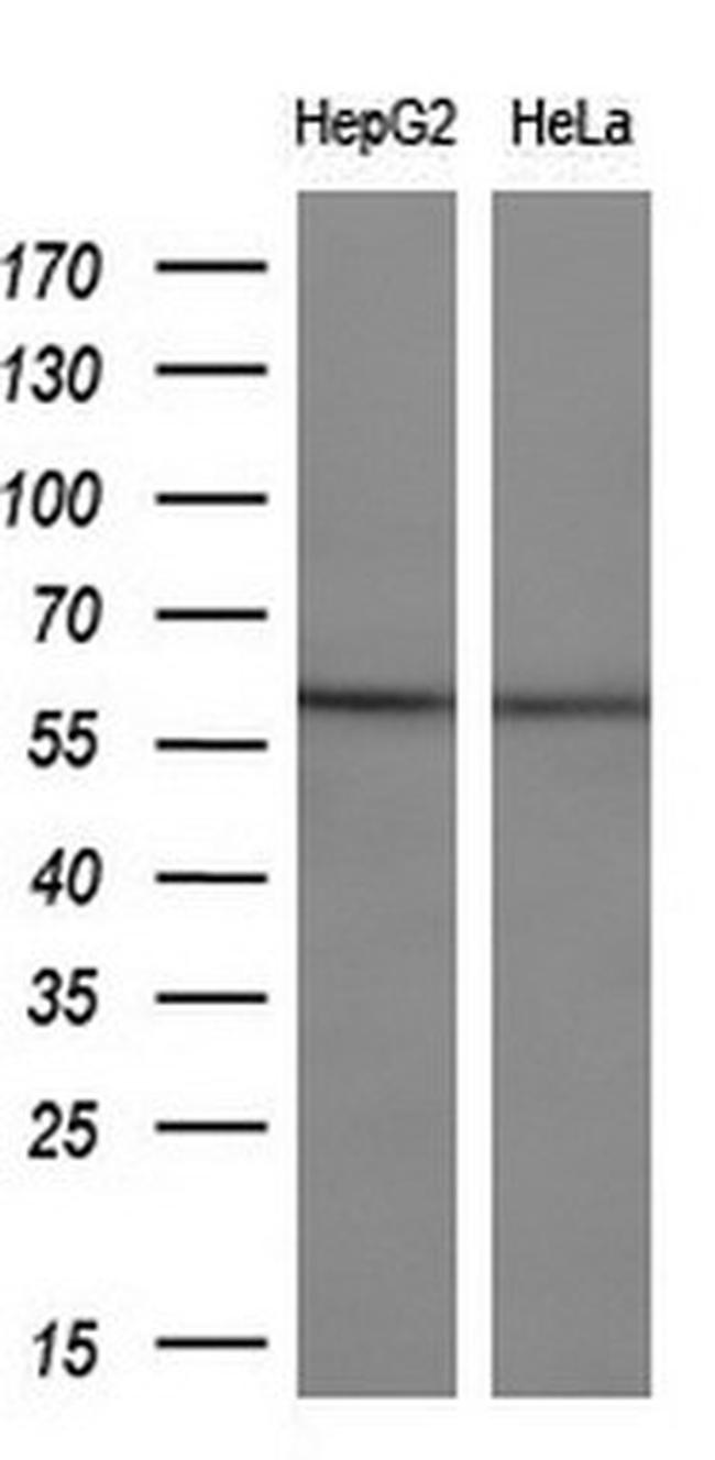 ETS2 Antibody in Western Blot (WB)