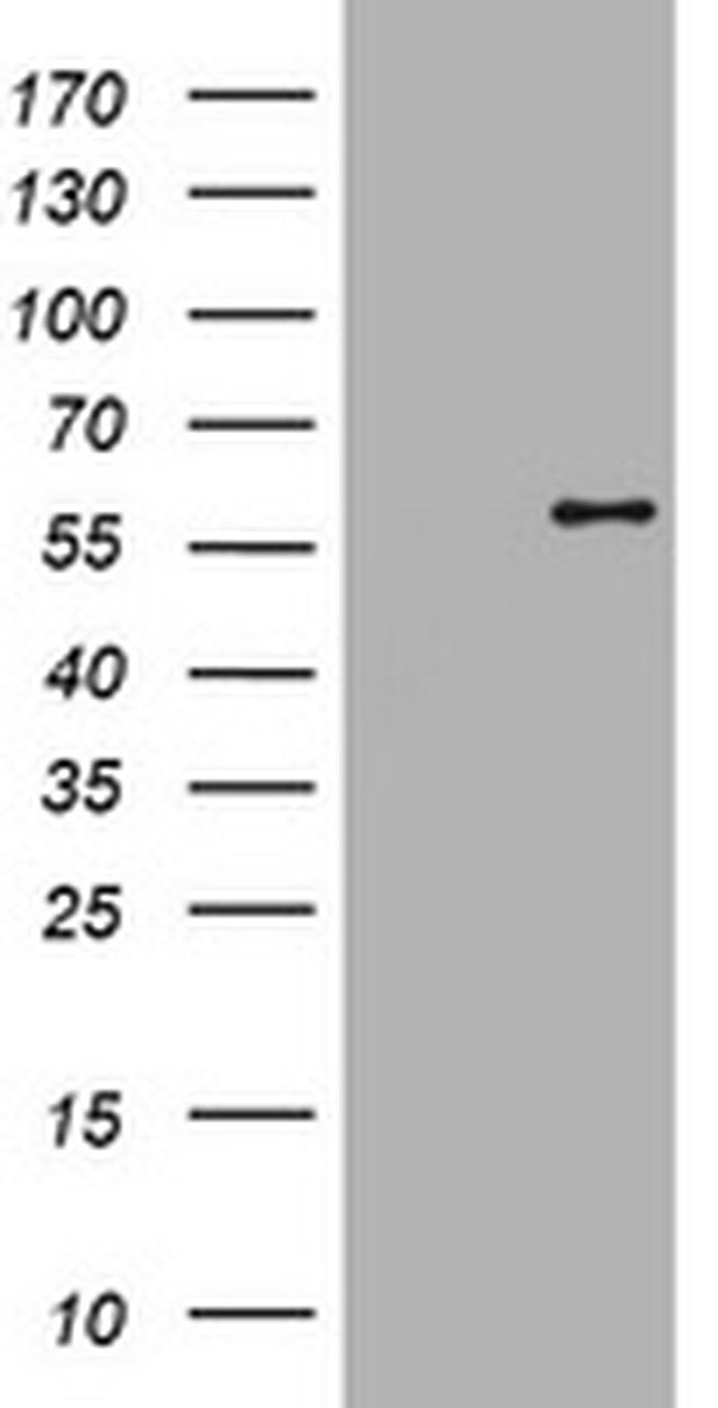 ETS2 Antibody in Western Blot (WB)