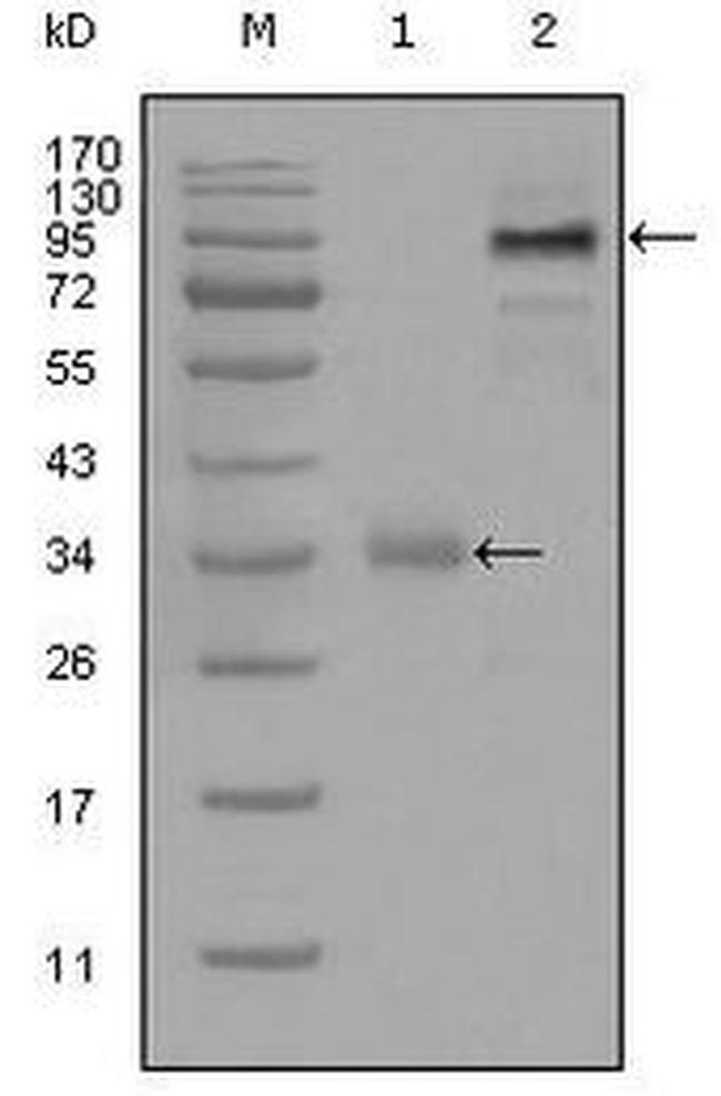 ETV1 Antibody in Western Blot (WB)