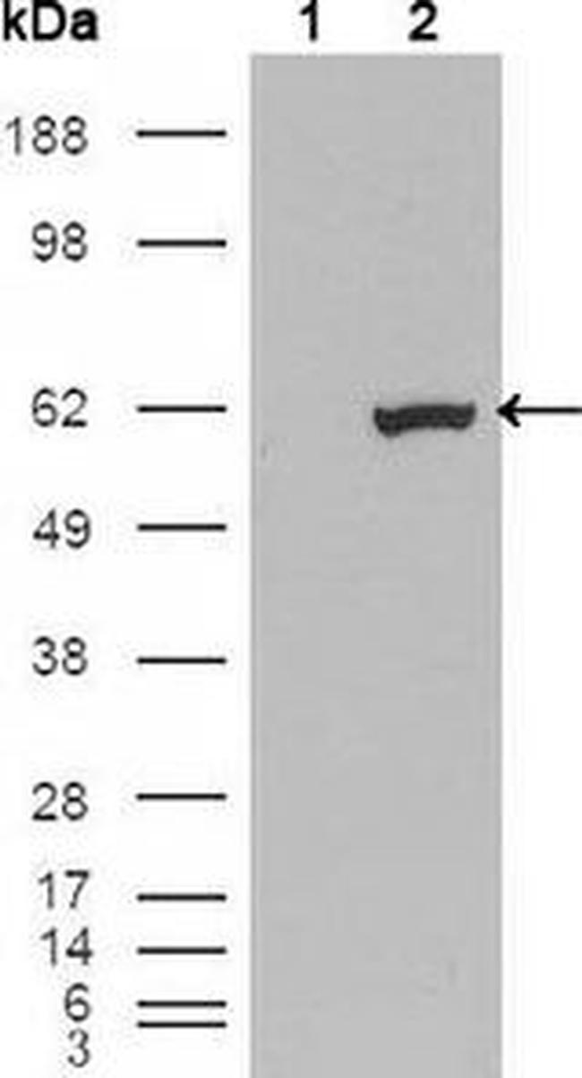 ETV1 Antibody in Western Blot (WB)