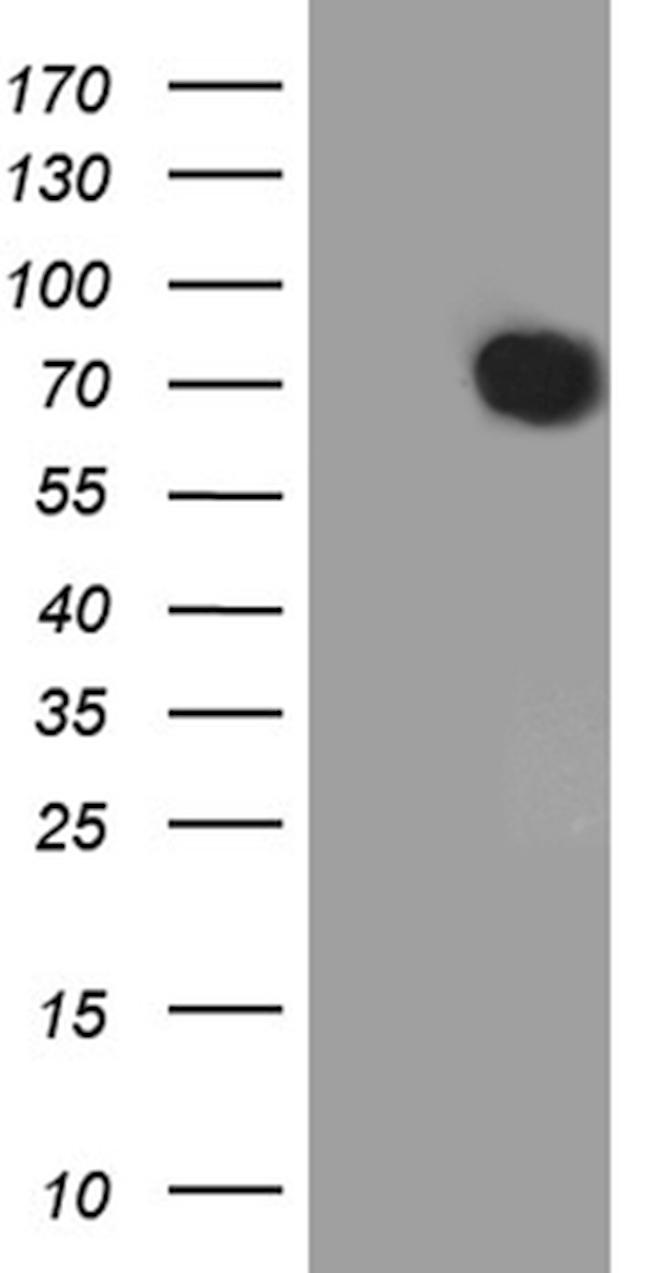 ETV4 Antibody in Western Blot (WB)