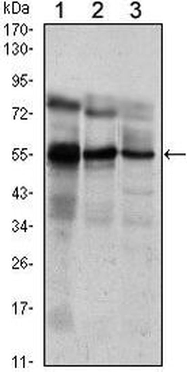 ETV5 Antibody in Western Blot (WB)