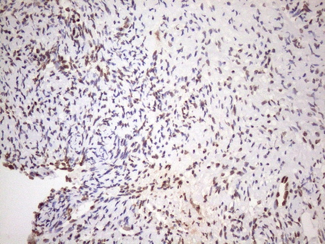 EXOSC1 Antibody in Immunohistochemistry (Paraffin) (IHC (P))