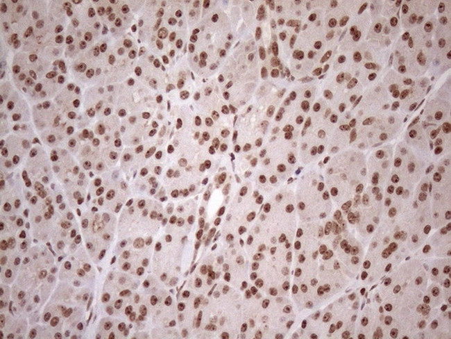 EXOSC1 Antibody in Immunohistochemistry (Paraffin) (IHC (P))