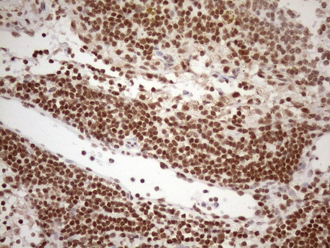 EXOSC1 Antibody in Immunohistochemistry (Paraffin) (IHC (P))