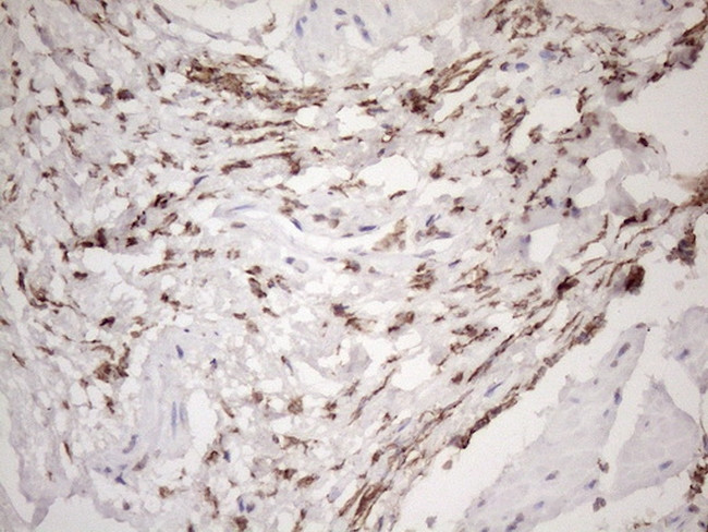 EXOSC1 Antibody in Immunohistochemistry (Paraffin) (IHC (P))