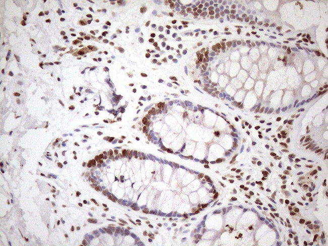 EXOSC1 Antibody in Immunohistochemistry (Paraffin) (IHC (P))