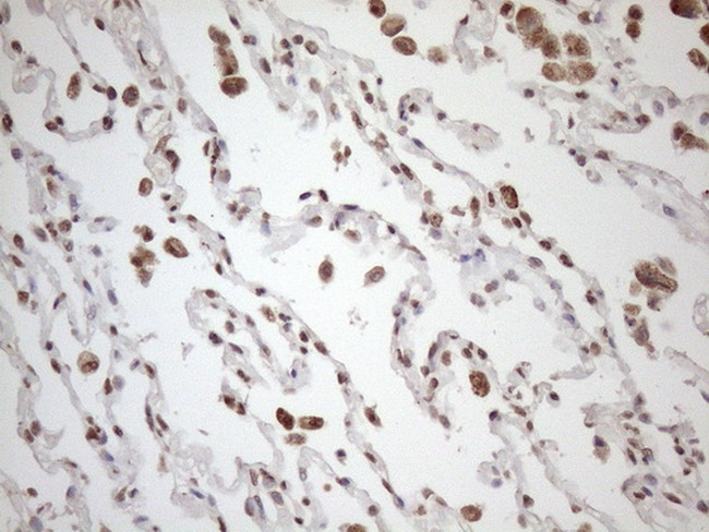 EXOSC1 Antibody in Immunohistochemistry (Paraffin) (IHC (P))