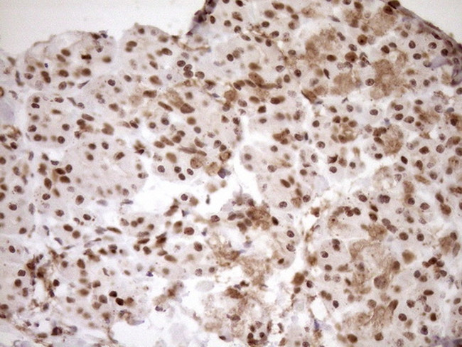 EXOSC1 Antibody in Immunohistochemistry (Paraffin) (IHC (P))