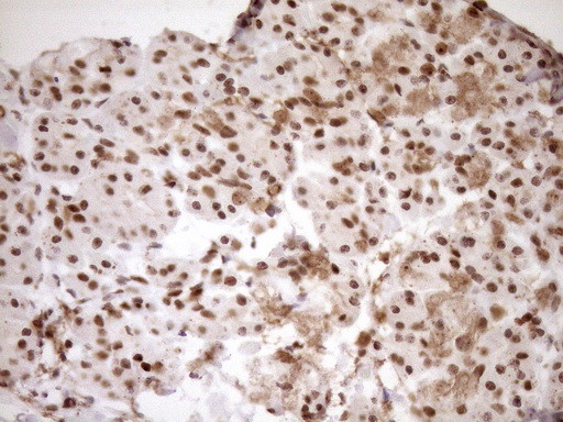 EXOSC1 Antibody in Immunohistochemistry (Paraffin) (IHC (P))