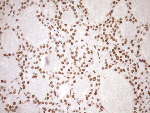 EXOSC1 Antibody in Immunohistochemistry (Paraffin) (IHC (P))