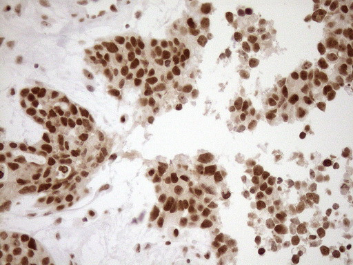 EXOSC1 Antibody in Immunohistochemistry (Paraffin) (IHC (P))