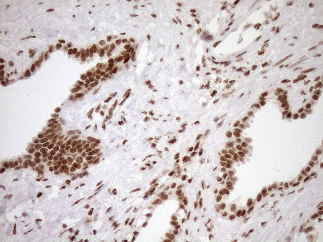 EXOSC1 Antibody in Immunohistochemistry (Paraffin) (IHC (P))