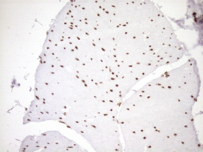 EXOSC1 Antibody in Immunohistochemistry (Paraffin) (IHC (P))