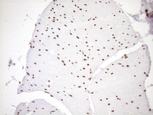 EXOSC1 Antibody in Immunohistochemistry (Paraffin) (IHC (P))