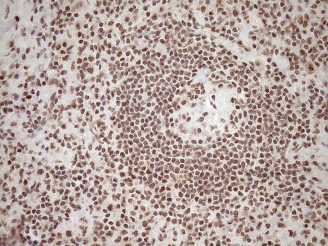 EXOSC1 Antibody in Immunohistochemistry (Paraffin) (IHC (P))