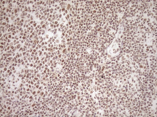 EXOSC1 Antibody in Immunohistochemistry (Paraffin) (IHC (P))