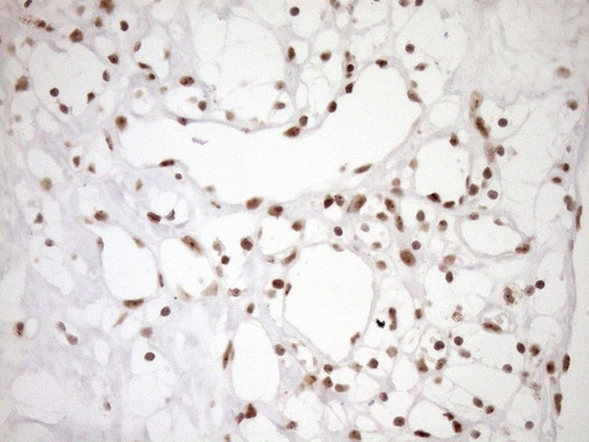 EXOSC1 Antibody in Immunohistochemistry (Paraffin) (IHC (P))