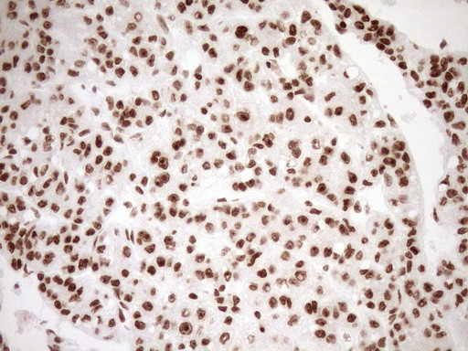 EXOSC1 Antibody in Immunohistochemistry (Paraffin) (IHC (P))