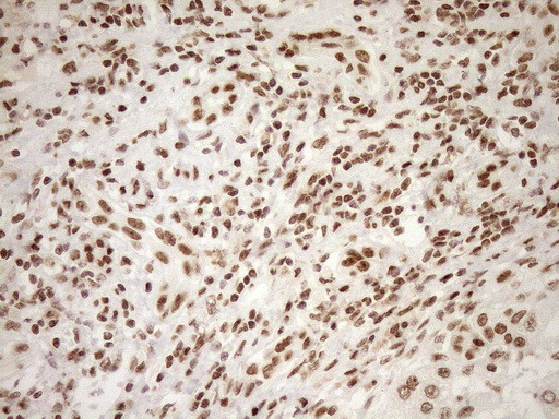 EXOSC1 Antibody in Immunohistochemistry (Paraffin) (IHC (P))