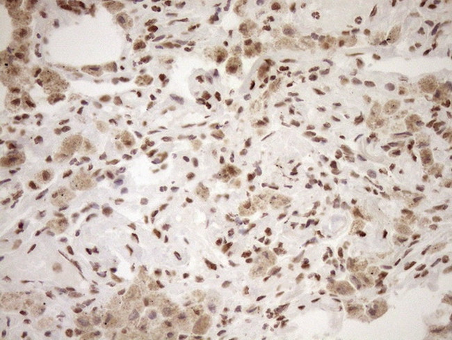 EXOSC1 Antibody in Immunohistochemistry (Paraffin) (IHC (P))