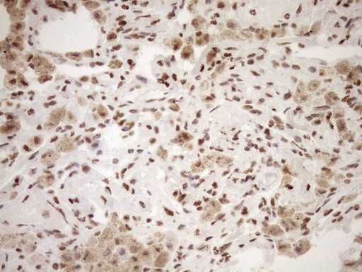 EXOSC1 Antibody in Immunohistochemistry (Paraffin) (IHC (P))