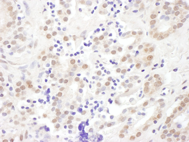 EXOSC10 Antibody in Immunohistochemistry (IHC)