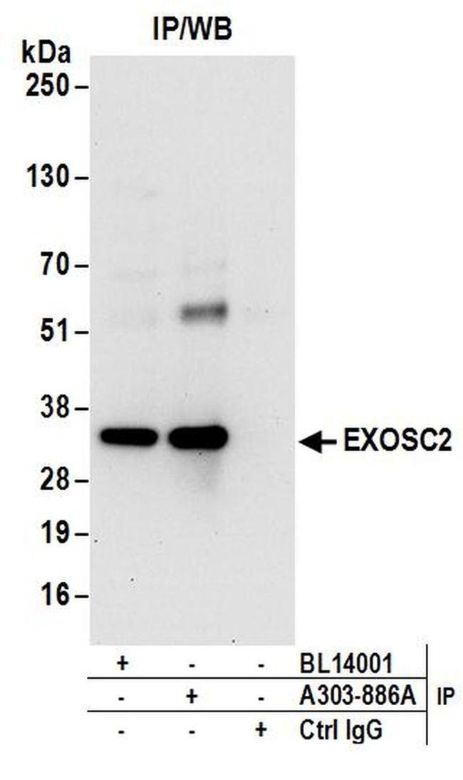 EXOSC2 Antibody in Western Blot (WB)