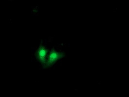 EXOSC7 Antibody in Immunocytochemistry (ICC/IF)