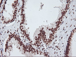 EXOSC7 Antibody in Immunohistochemistry (Paraffin) (IHC (P))