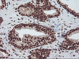 EXOSC7 Antibody in Immunohistochemistry (Paraffin) (IHC (P))