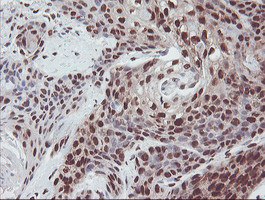 EXOSC7 Antibody in Immunohistochemistry (Paraffin) (IHC (P))