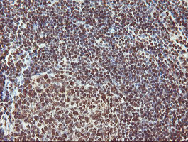 EXOSC7 Antibody in Immunohistochemistry (Paraffin) (IHC (P))