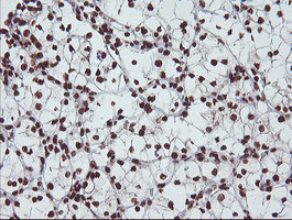 EXOSC7 Antibody in Immunohistochemistry (Paraffin) (IHC (P))