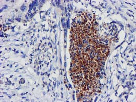 EXOSC7 Antibody in Immunohistochemistry (Paraffin) (IHC (P))