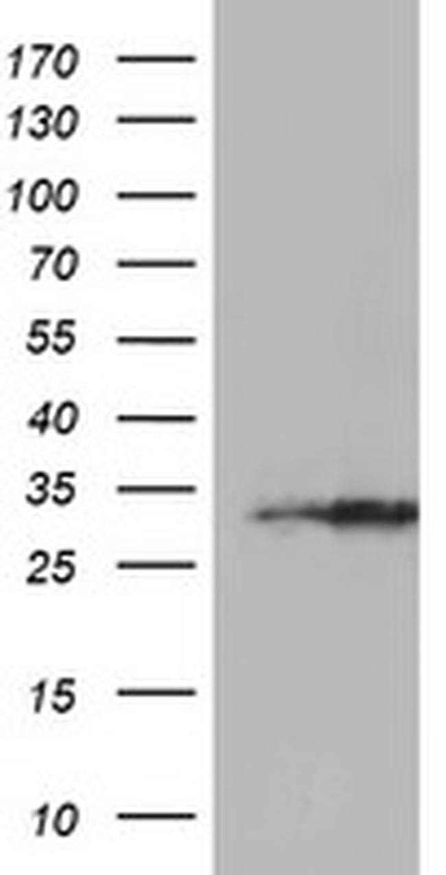 EXOSC7 Antibody in Western Blot (WB)